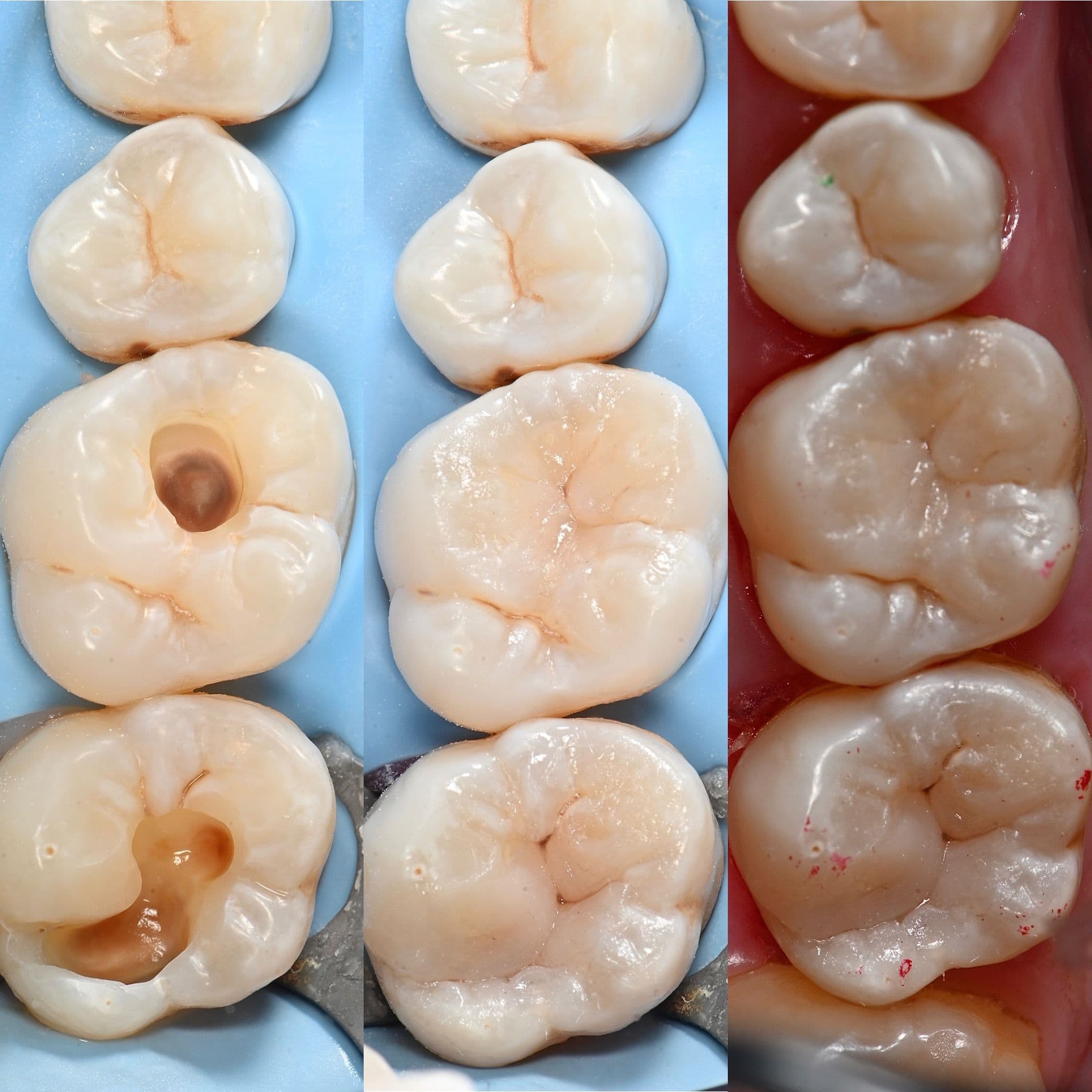 Before and after case 1
