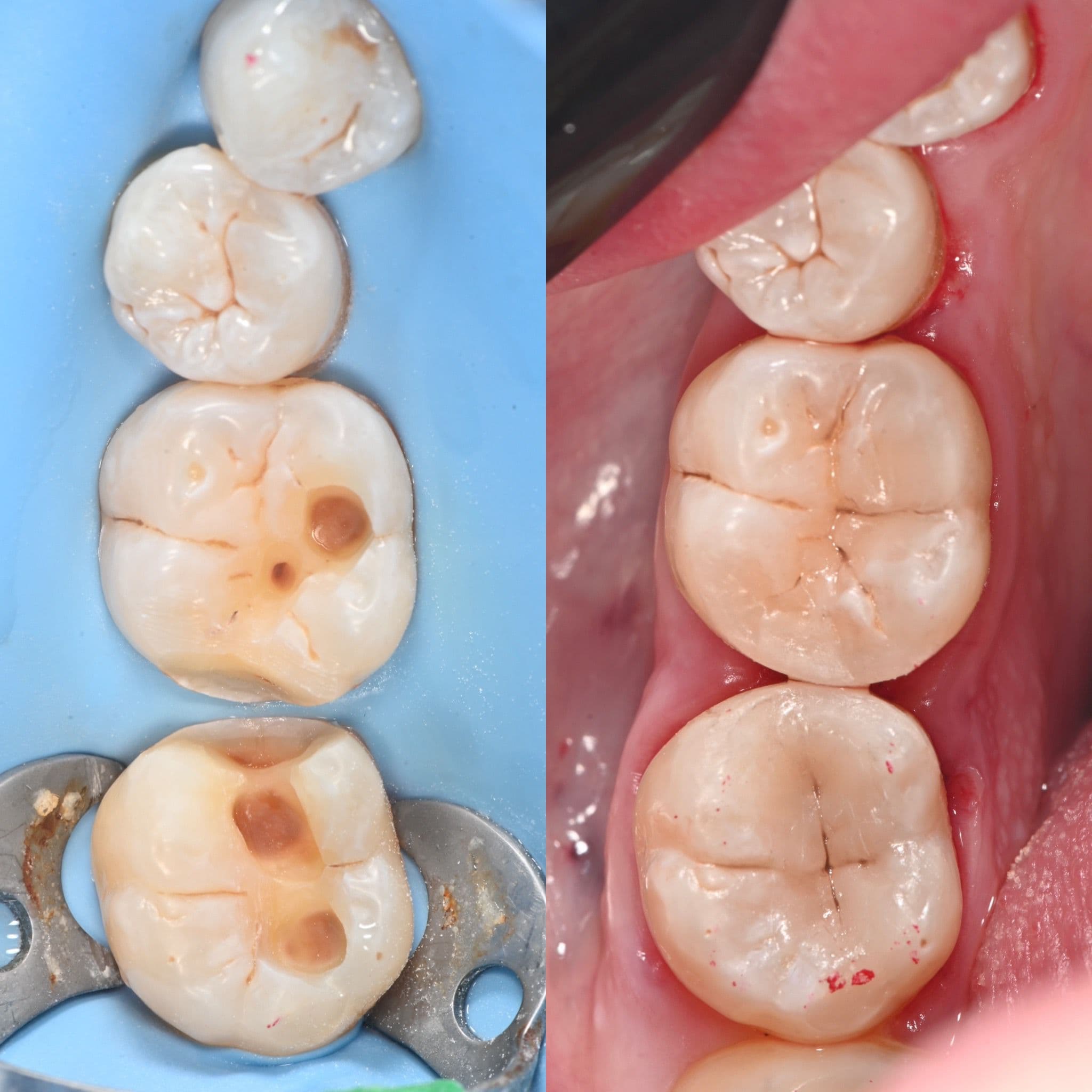 Before and after case 2