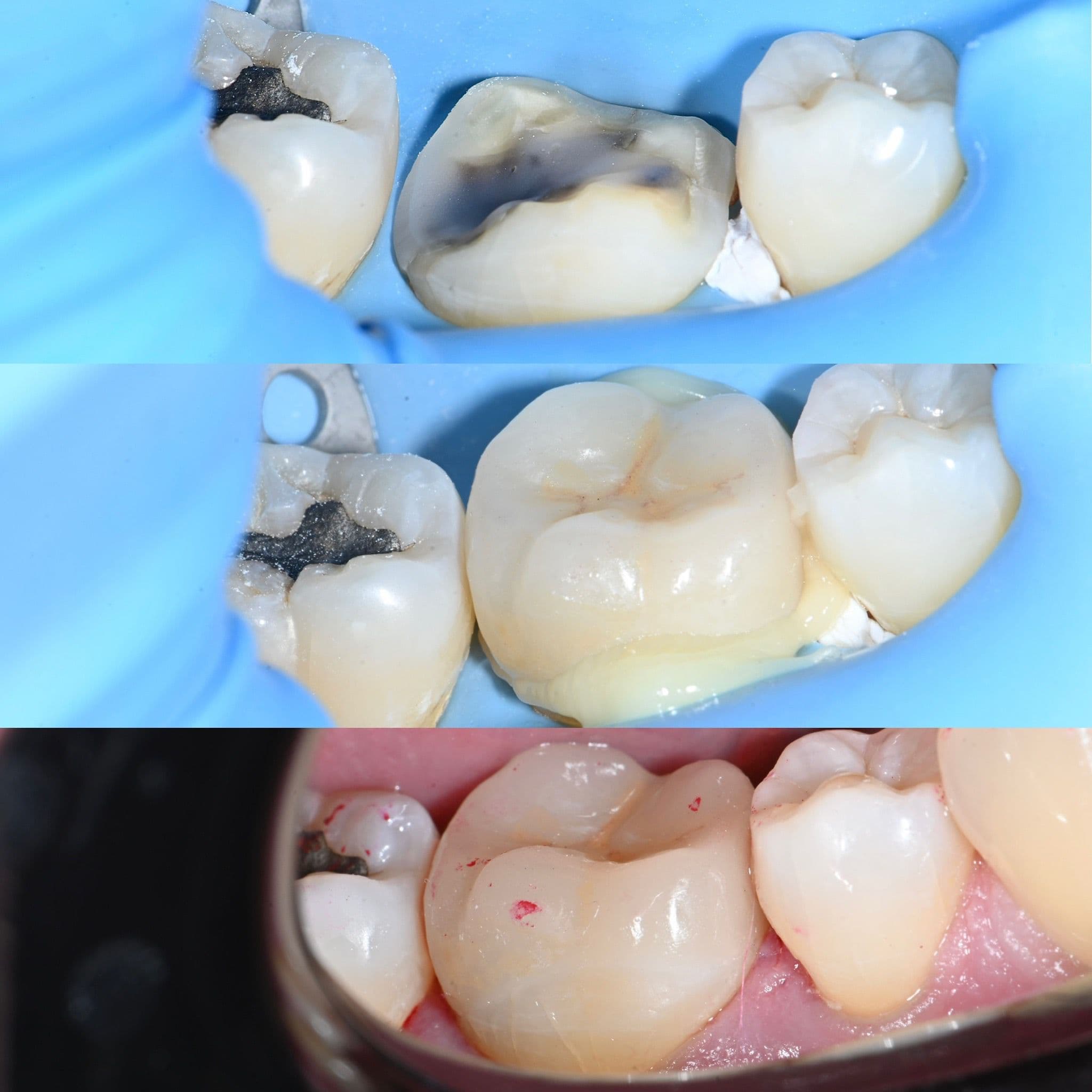 Before and after case 3