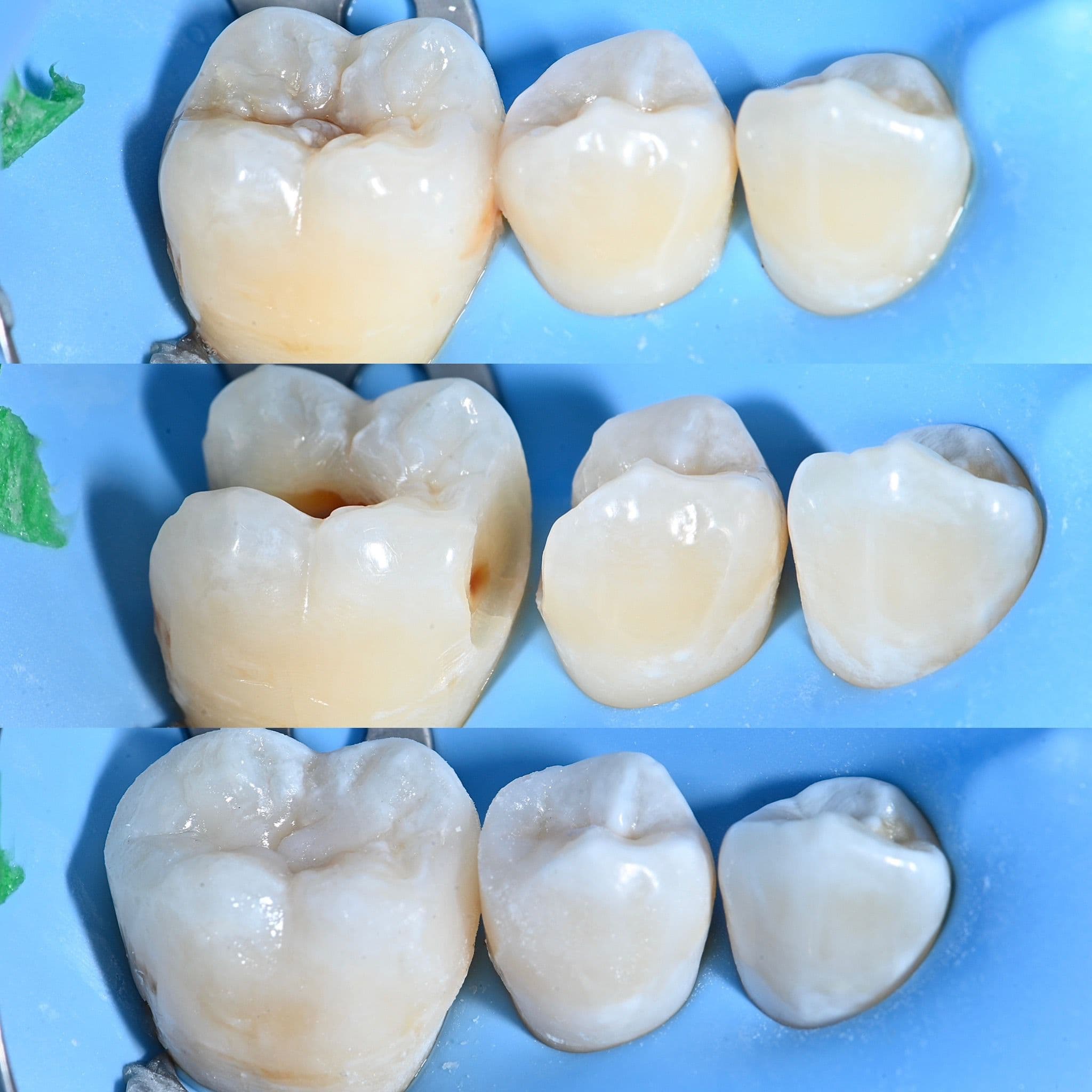 Before and after case 4